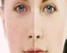 چگونه با گیاهان دارویی سلامت پوست را بهبود دهیم