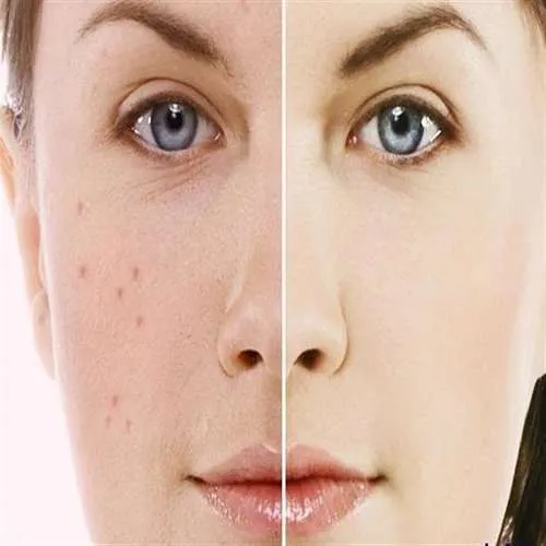 چگونه با گیاهان دارویی سلامت پوست را بهبود دهیم