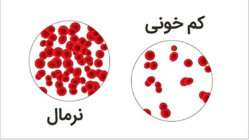 درمان کمخونی با شیره سیب
